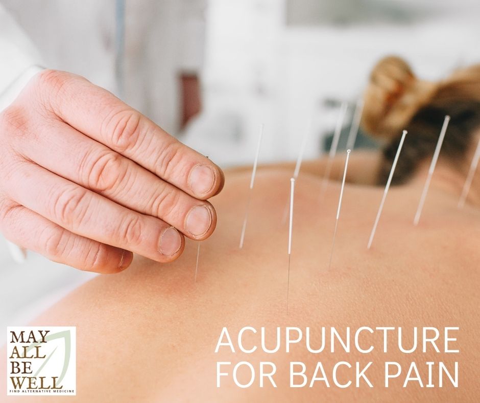 Acupuncture for Back Pain Does It Work? May All Be Well